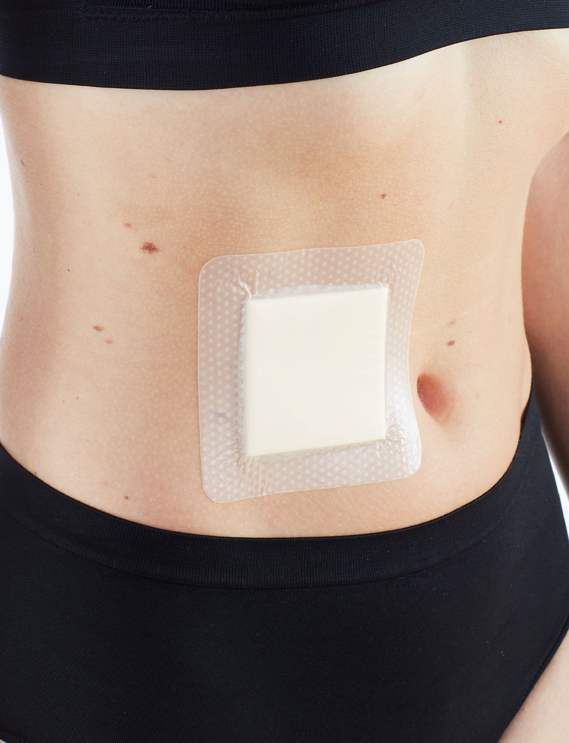 Neo G Silicone Foam Absorbent Dressing on stomach, zoomed in