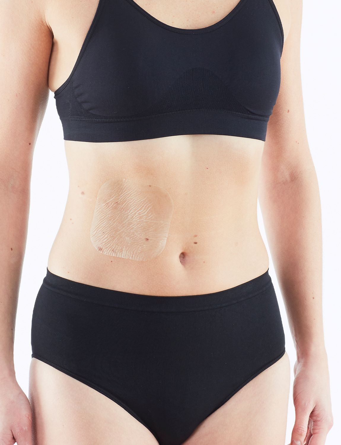 Neo G Ultra Thin Hydrocolloid on stomach, featuring 360 degrees waterproof seal